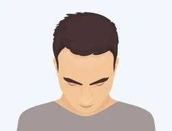 Stage 1