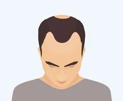 Stage 3