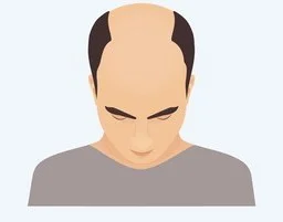 Stage 5