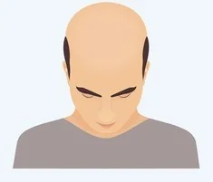 Stage 6