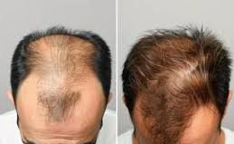 Before ----------------- After