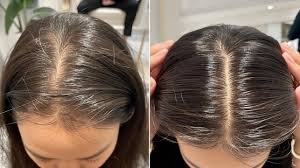 Before ----------------- After