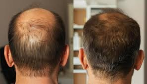Before ----------------- After